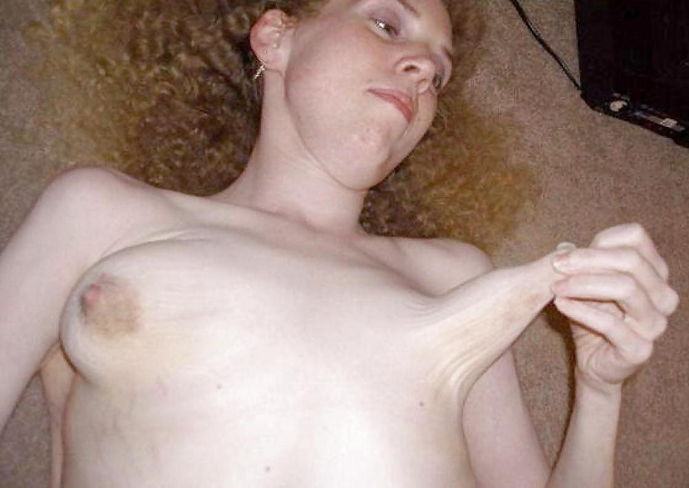 25P Deformed and saggy titts