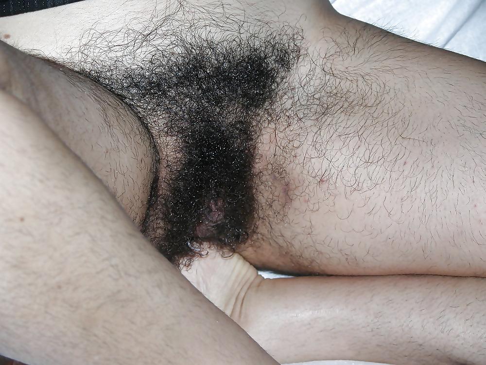 25P Hairy women 3