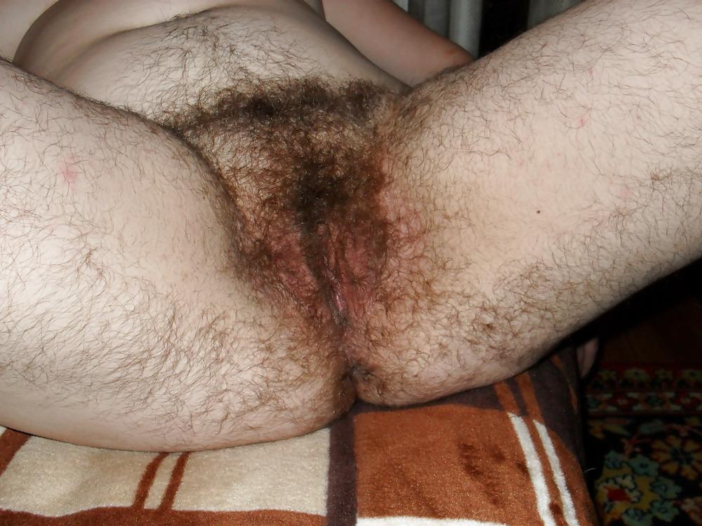 25P Hairy women 3