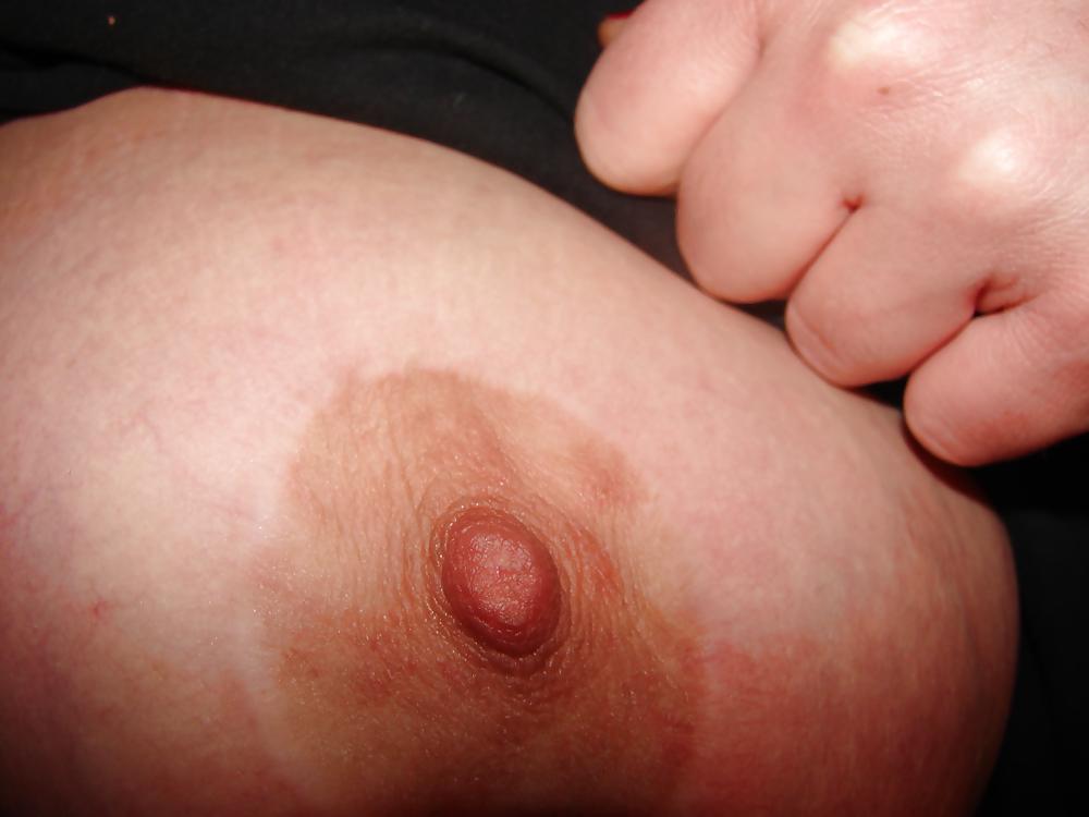 7P Friend In FishNet