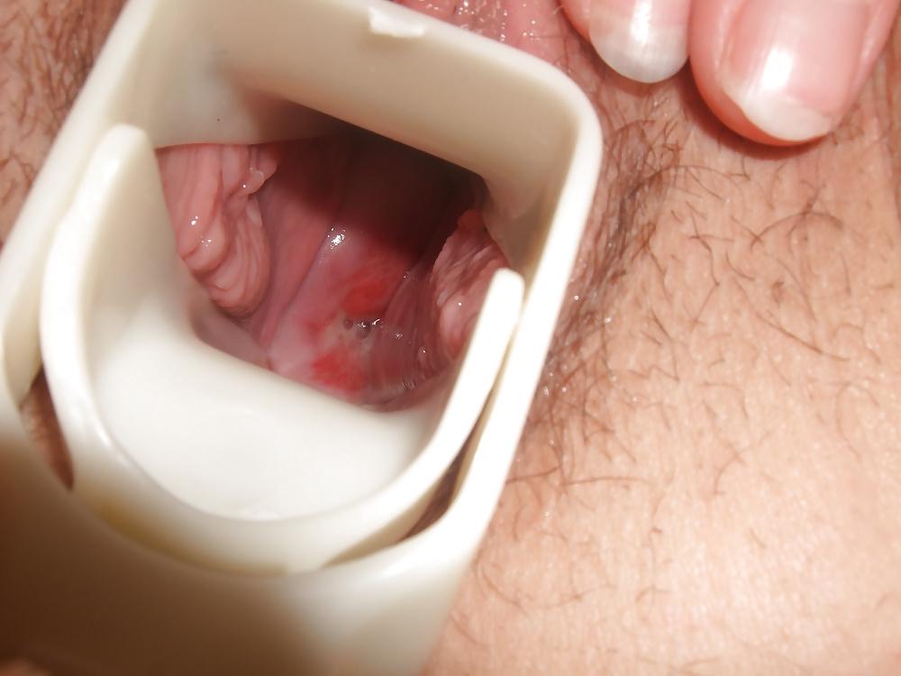 15P Gynecologist