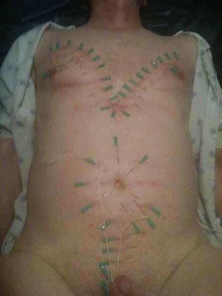 15P Bdsm male slave nipple torture