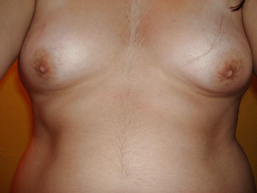 25P Hairy tits