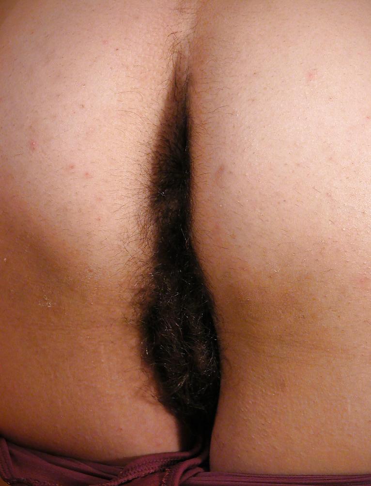25P Hairy Lesbians 1