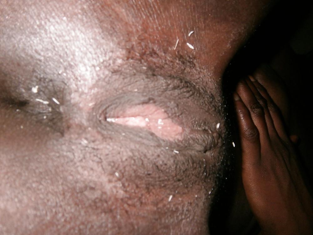 25P Female Infibulation