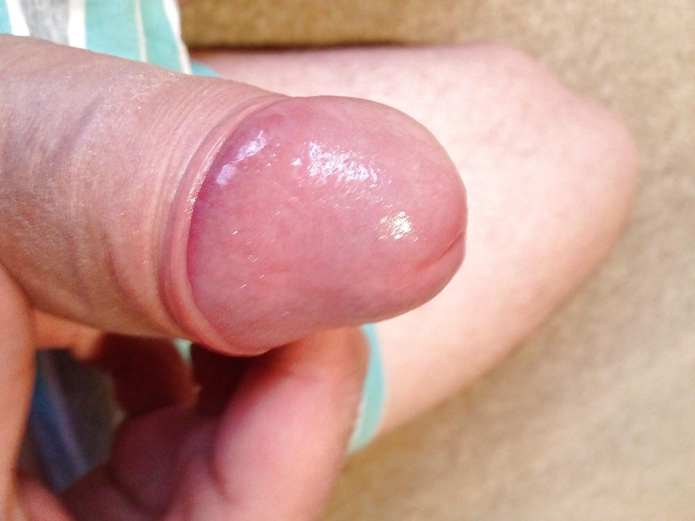 12P Anal time