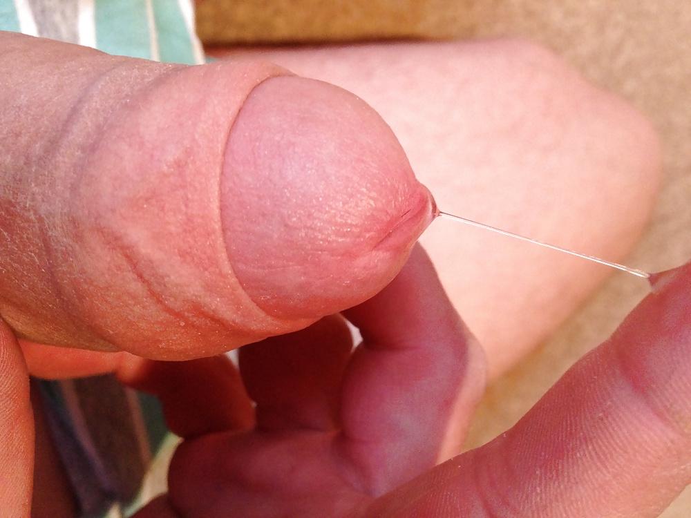 12P Anal time