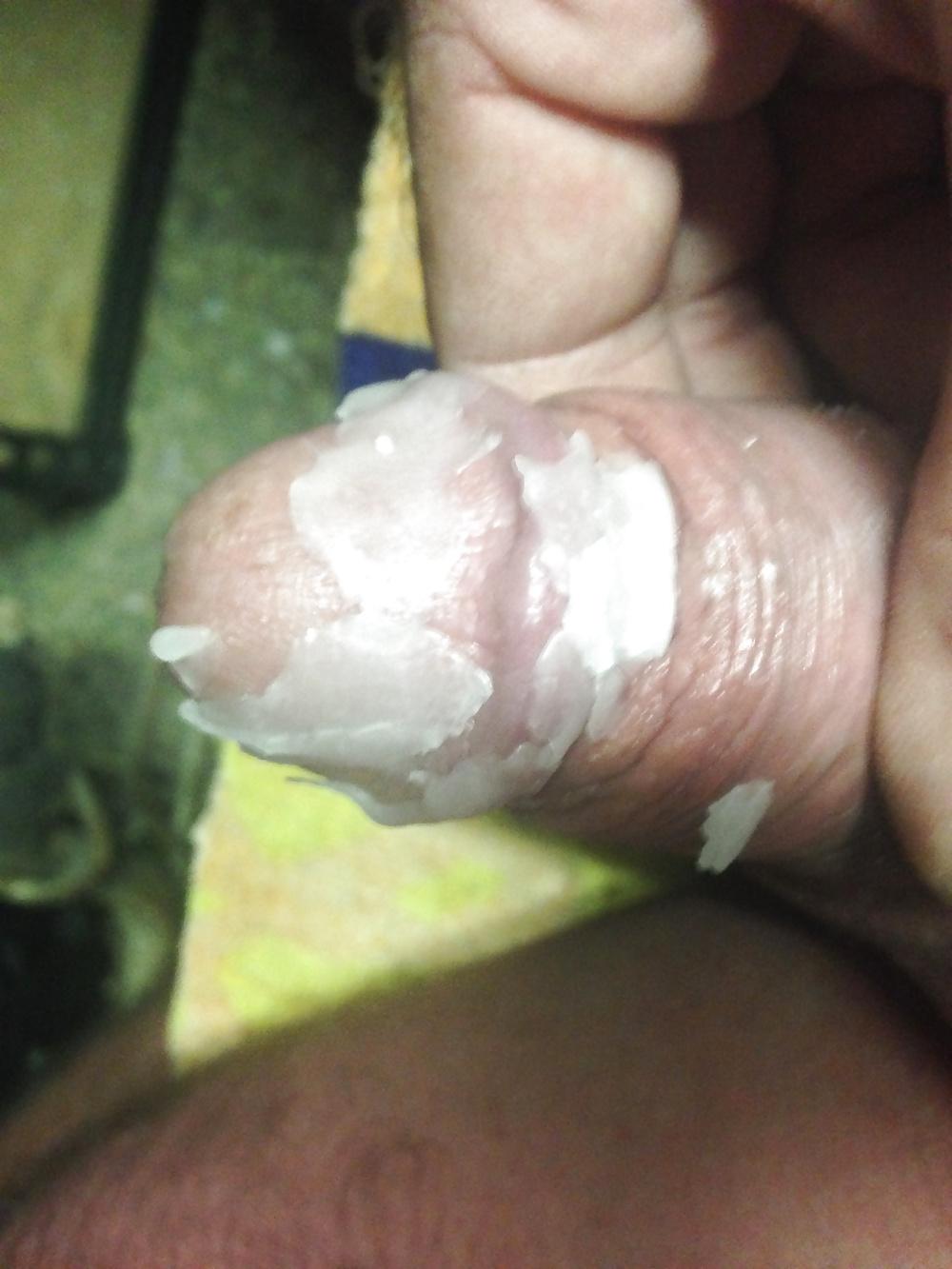 10P Pouring hot candle wax on my cock.
