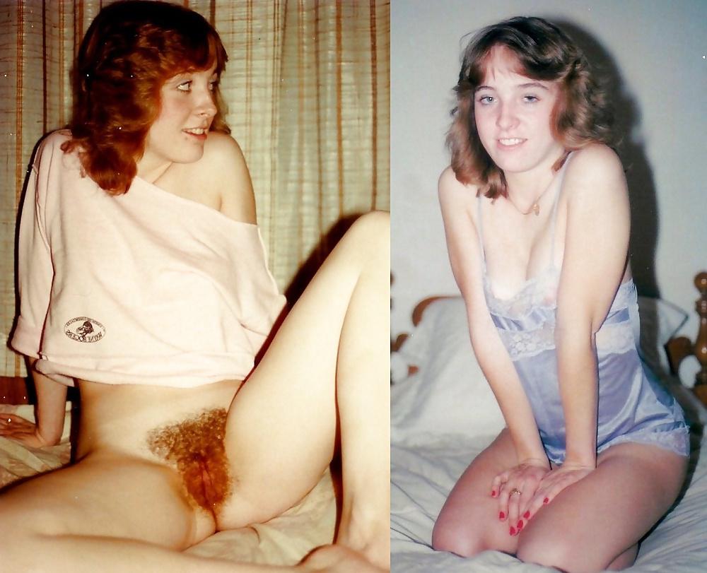 25P Bottomless and Hairy Dressed & Undressed
