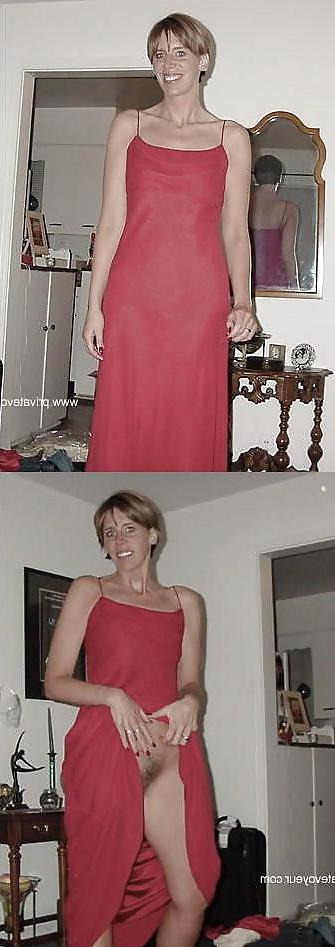 25P Bottomless and Hairy Dressed & Undressed