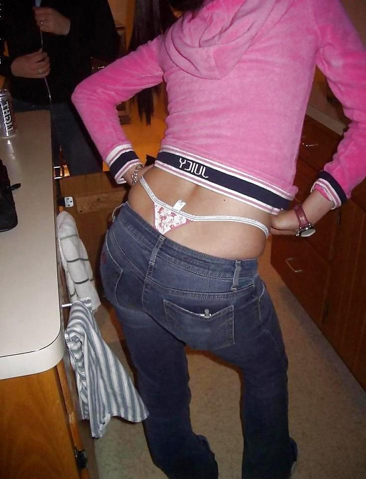 25P WhaleTail 1