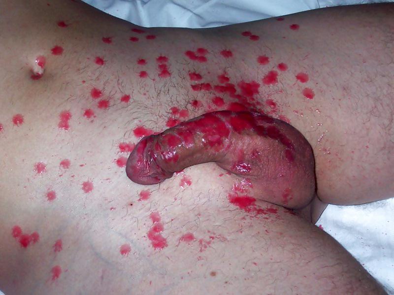 17P BDSM