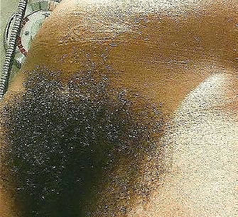25P Big Hairy Bush