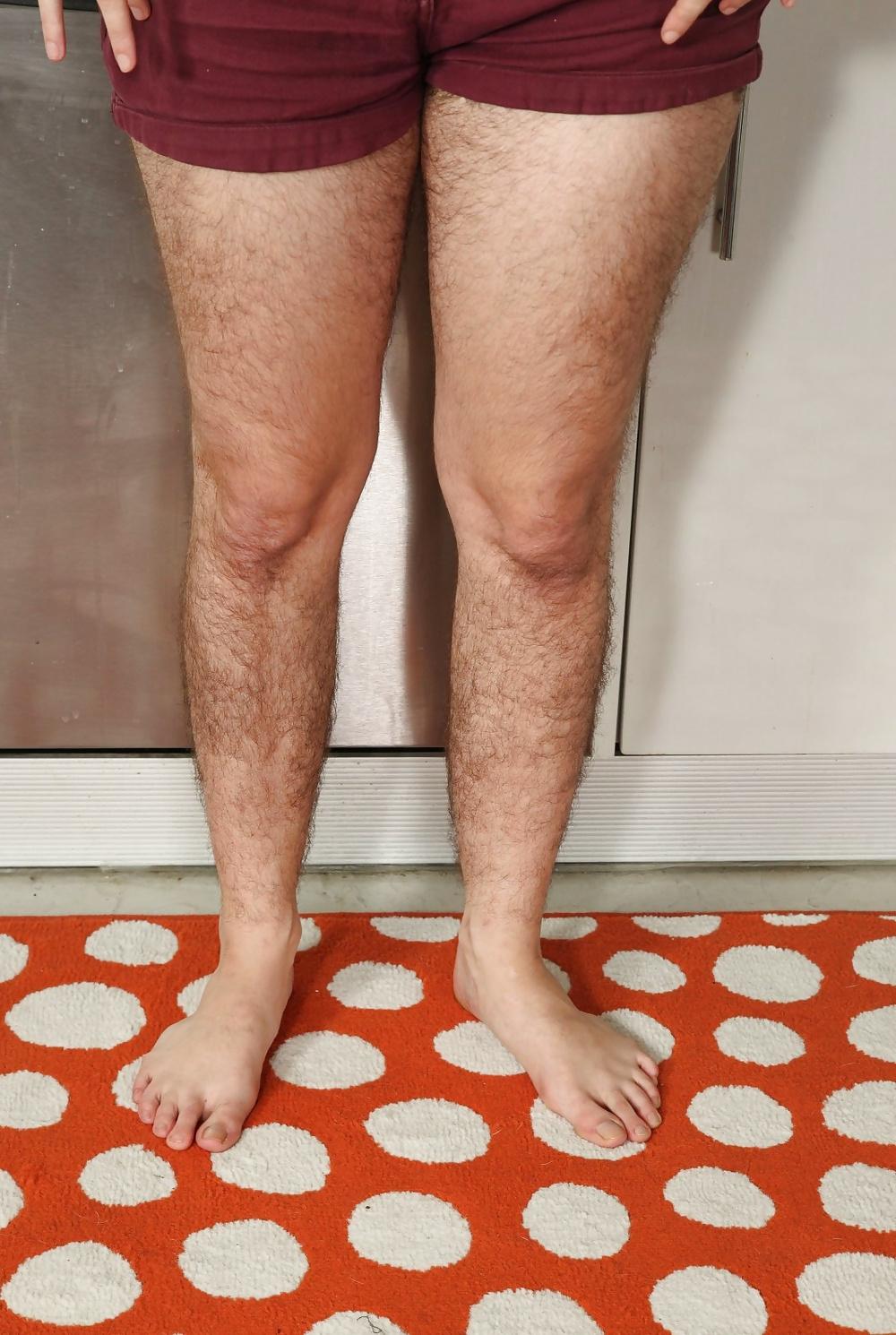 25P Hairy Armpits - Harley Hex II 