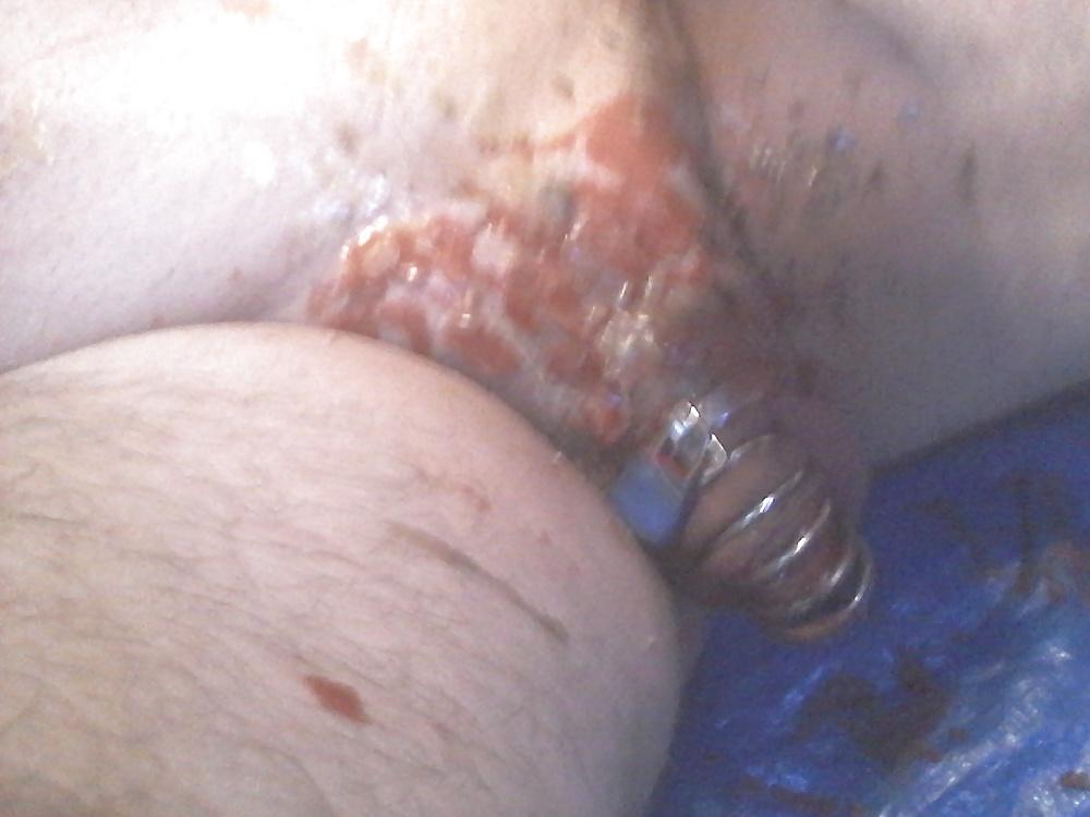 24P Hot wax