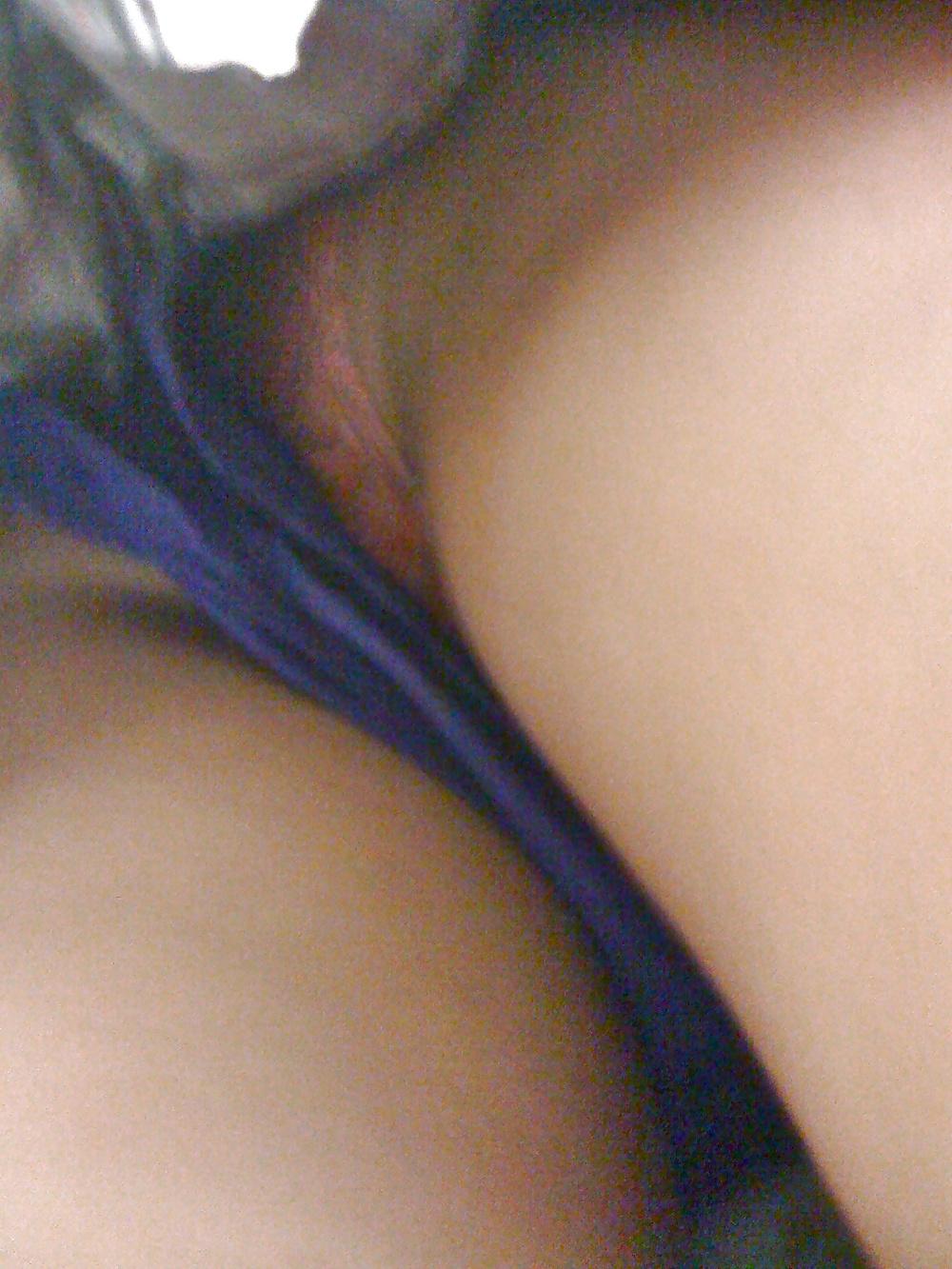 25P Hairy Upshorts