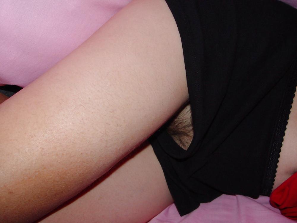 25P Hairy Upshorts