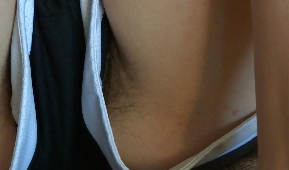 25P Hairy Upshorts