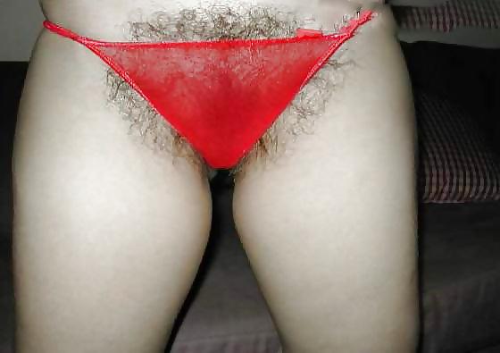 22P HAIRY