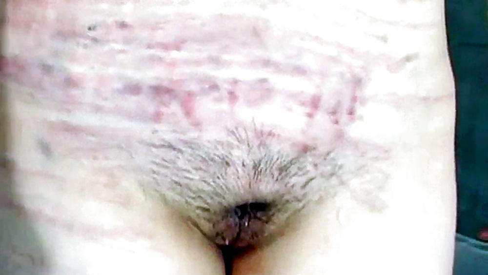 25P BdSm 1 bondage, spanking, slapping, whipping, torture