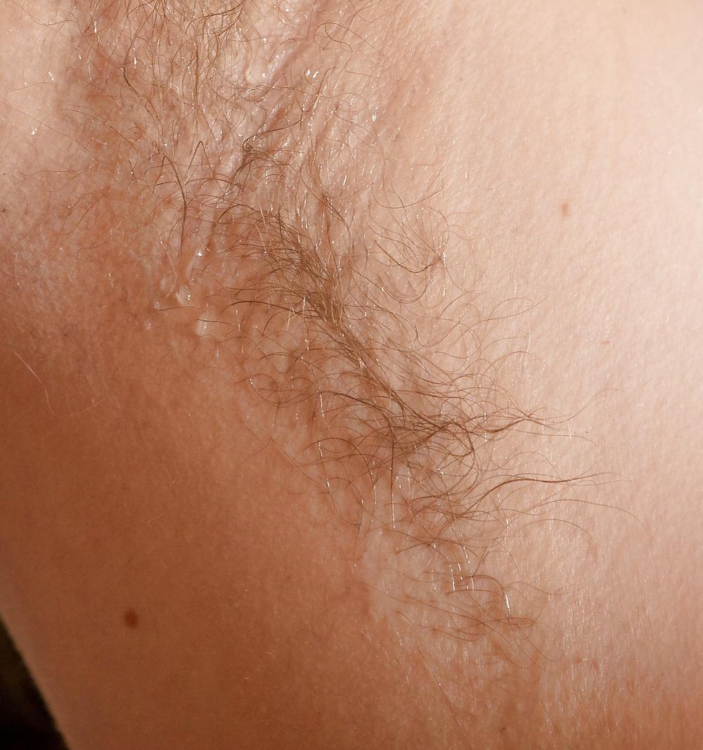 24P Hairy armpits 2