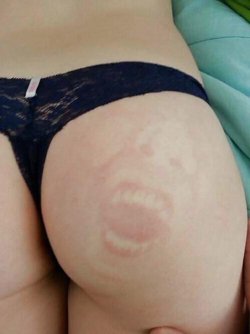 20P Ass