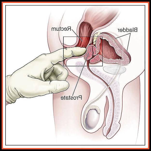 10P Aneros - massage de la prostate - Prostate massage