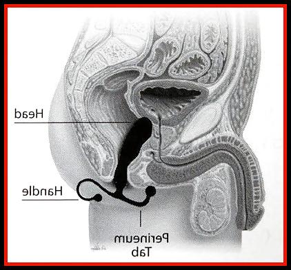 10P Aneros - massage de la prostate - Prostate massage