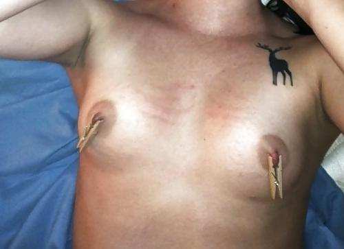 25P Nipple torture