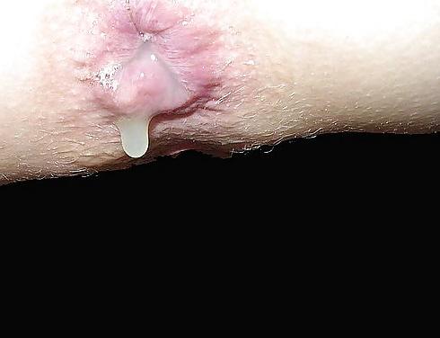 25P Open ass for fisting!