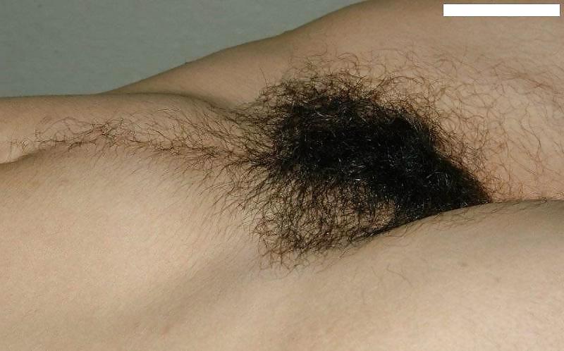 25P Hairy Girls 1