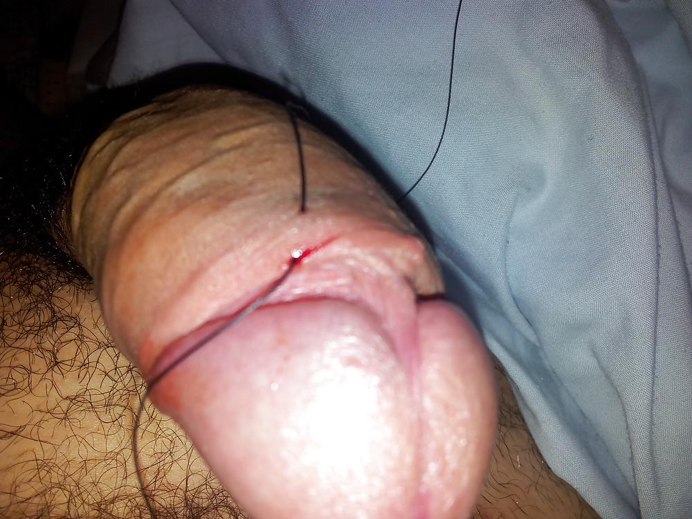 16P BDSM