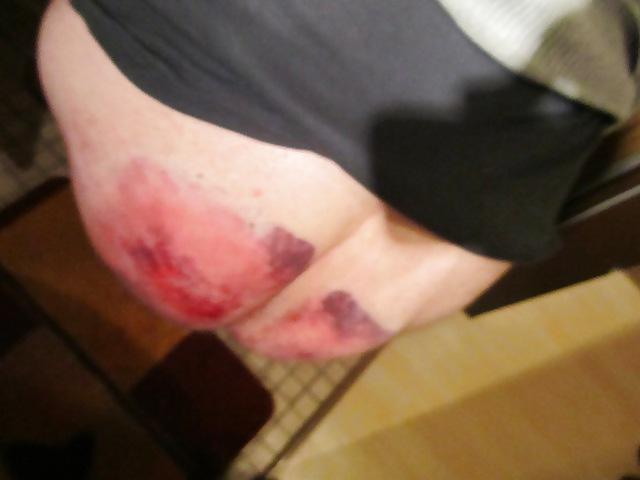 6P After the whipping