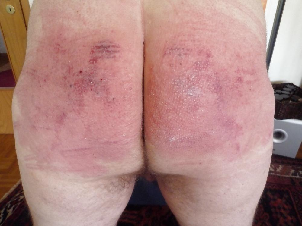 6P After the whipping