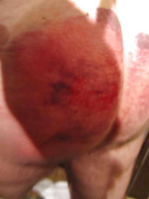 6P After the whipping