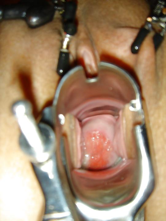 5P Gyno Swing by Request For Certain Friends