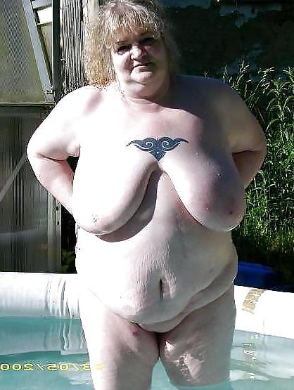 23P Stretch Marks, Scars and Saggy 3