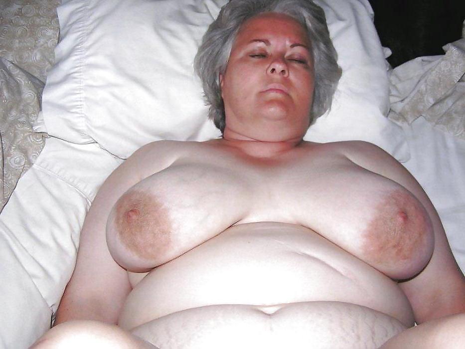25P Stretch Marks, Scars and Saggy 16