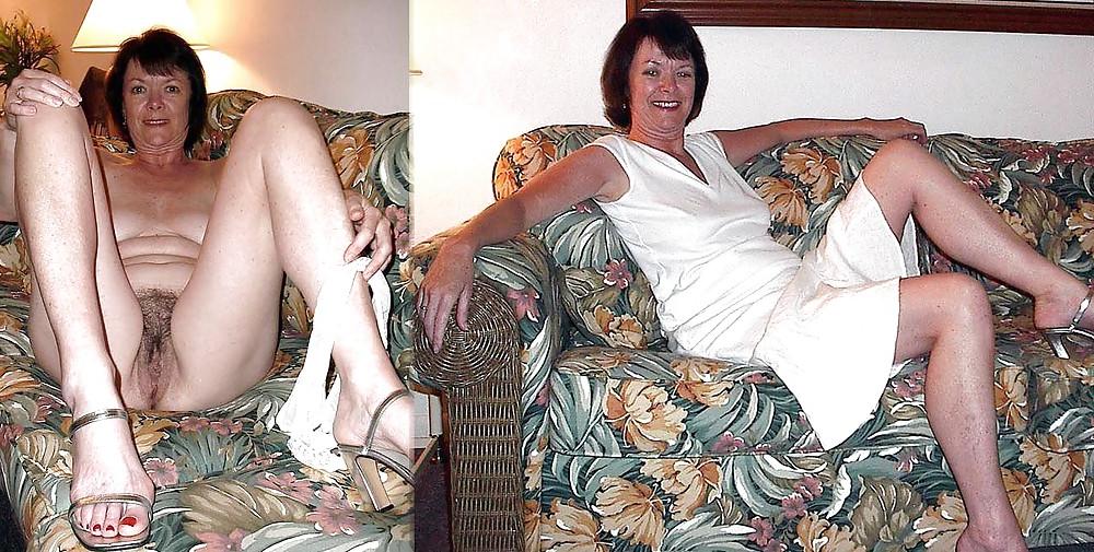 25P Dressed - Undressed Hairy Women Part 9