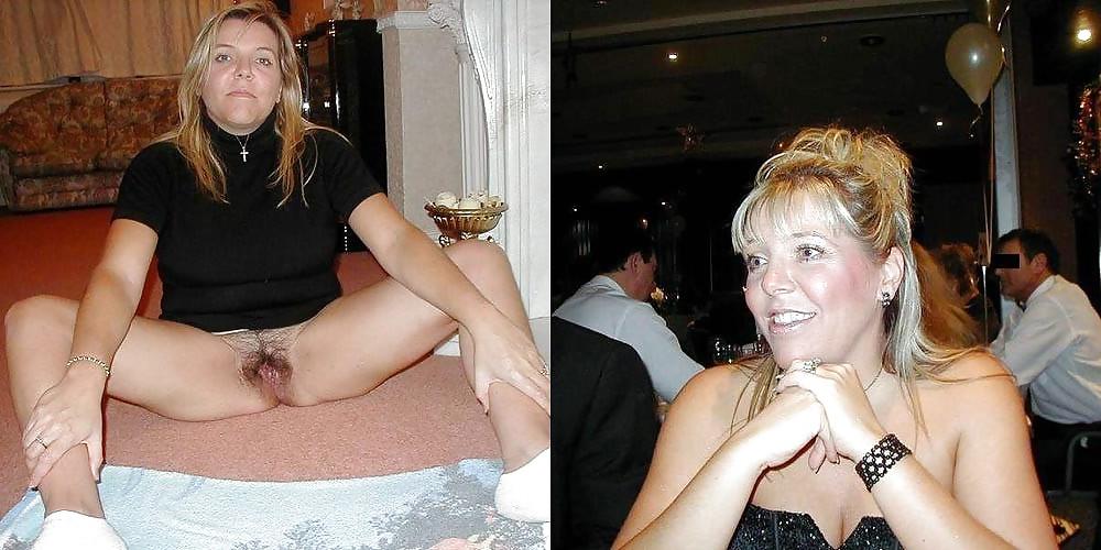 25P Dressed - Undressed Hairy Women Part 9