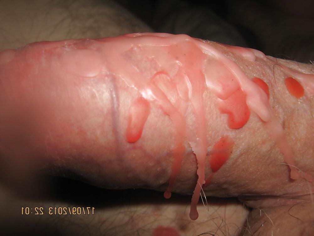 9P HOT WAX & PEGS