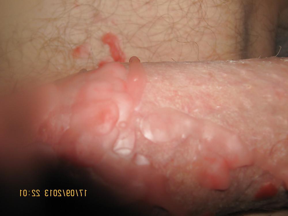 9P HOT WAX & PEGS