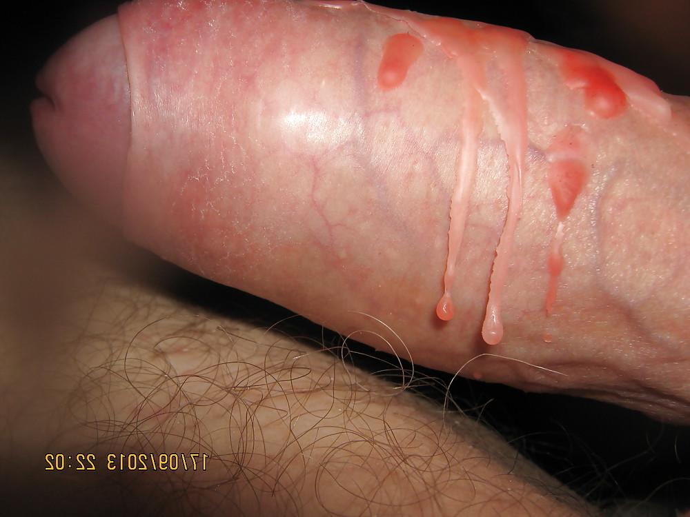 9P HOT WAX & PEGS
