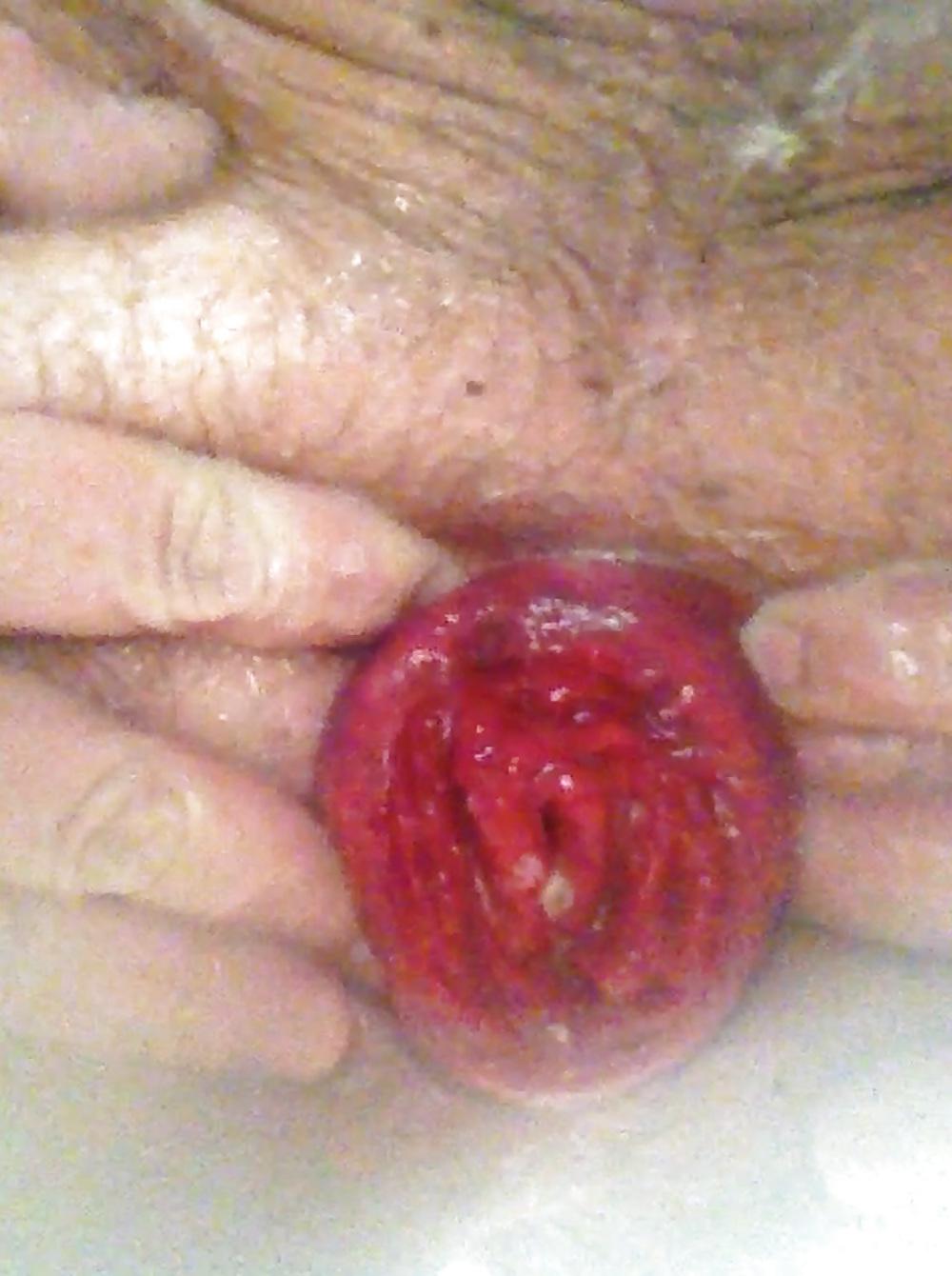25P SELF FISTING , GAPING , ROSEBUTT