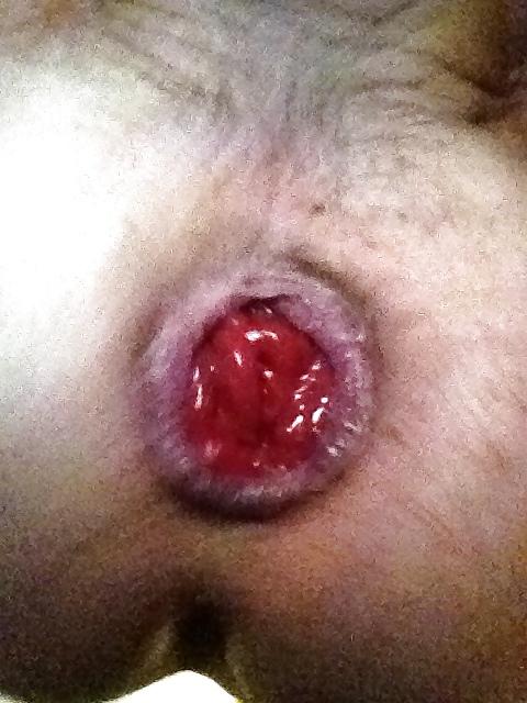 25P SELF FISTING , GAPING , ROSEBUTT