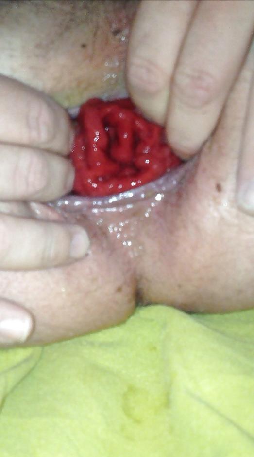 25P SELF FISTING , GAPING , ROSEBUTT