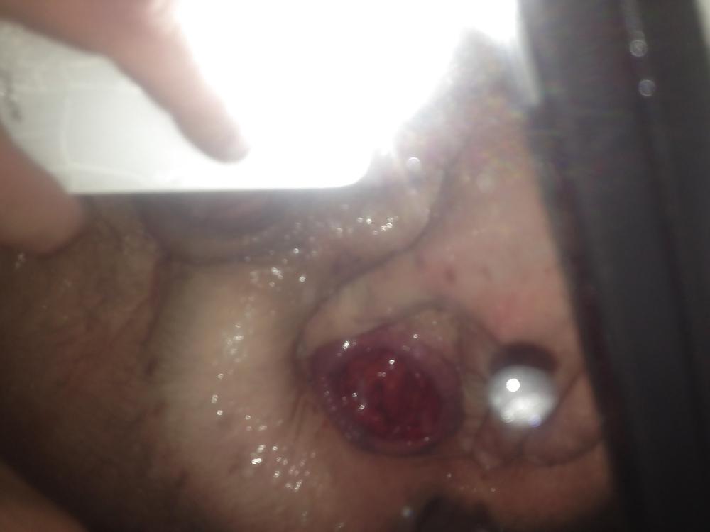 25P SELF FISTING , GAPING , ROSEBUTT