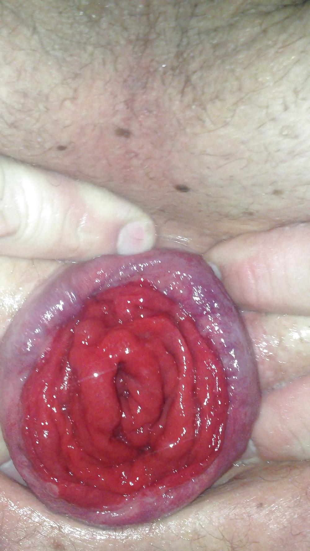 25P SELF FISTING , GAPING , ROSEBUTT