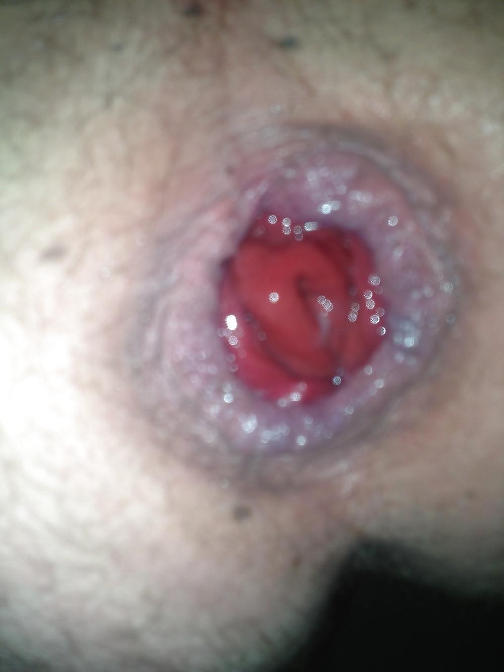 25P SELF FISTING , GAPING , ROSEBUTT