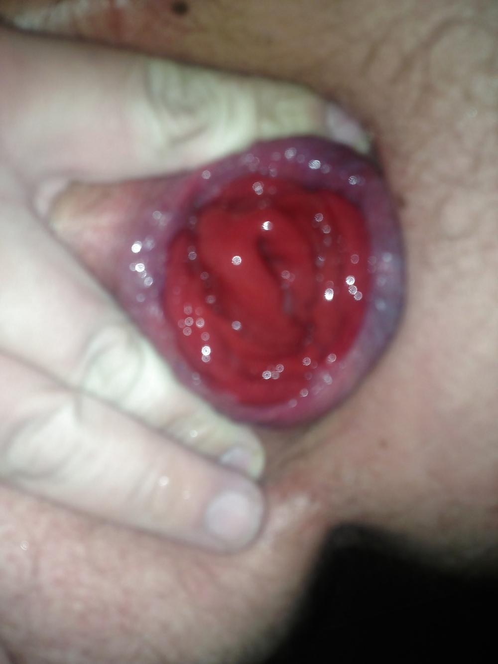 25P SELF FISTING , GAPING , ROSEBUTT